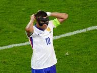 EURO 2024: Kylian Mbappe wearing his protective mask (AP)